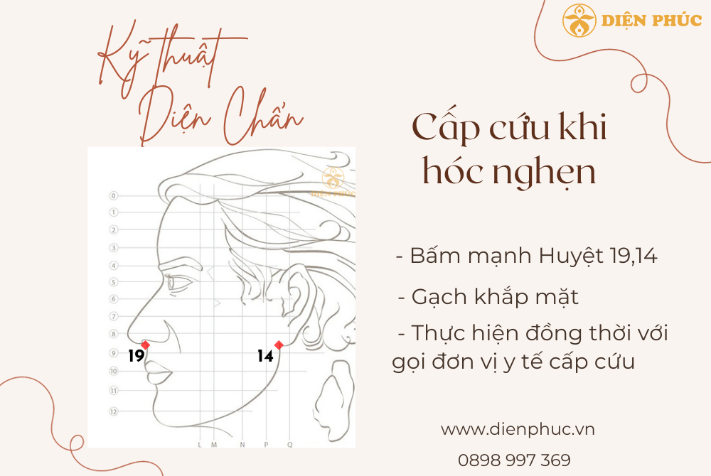 kỹ thuật diện chẩn cấp cứu khi hóc nghẹn