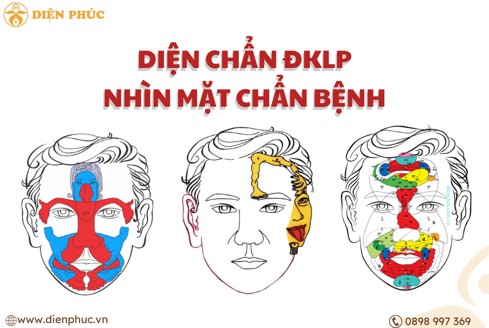 Diện Chẩn nhìn mặt đoán bệnh
