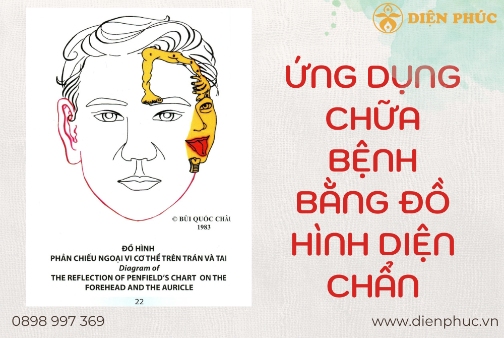 Đồ hình phản chiếu ngoại vi cơ thể trên trán và tai