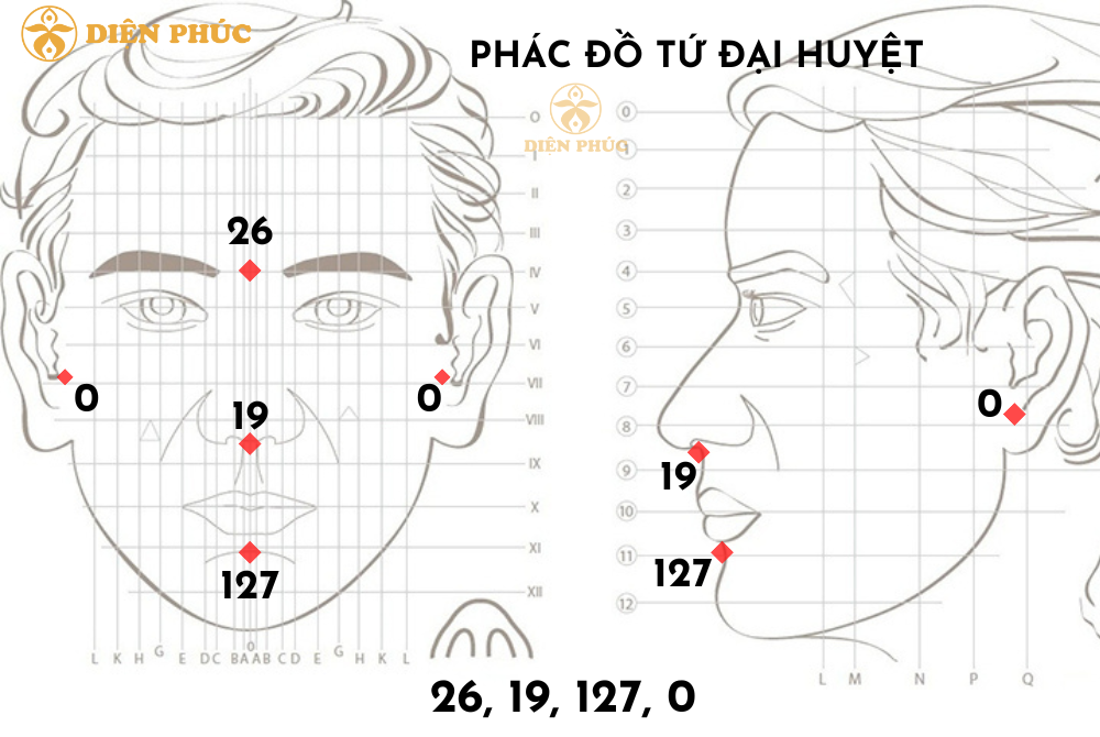 phác đồ tứ đại huyệt