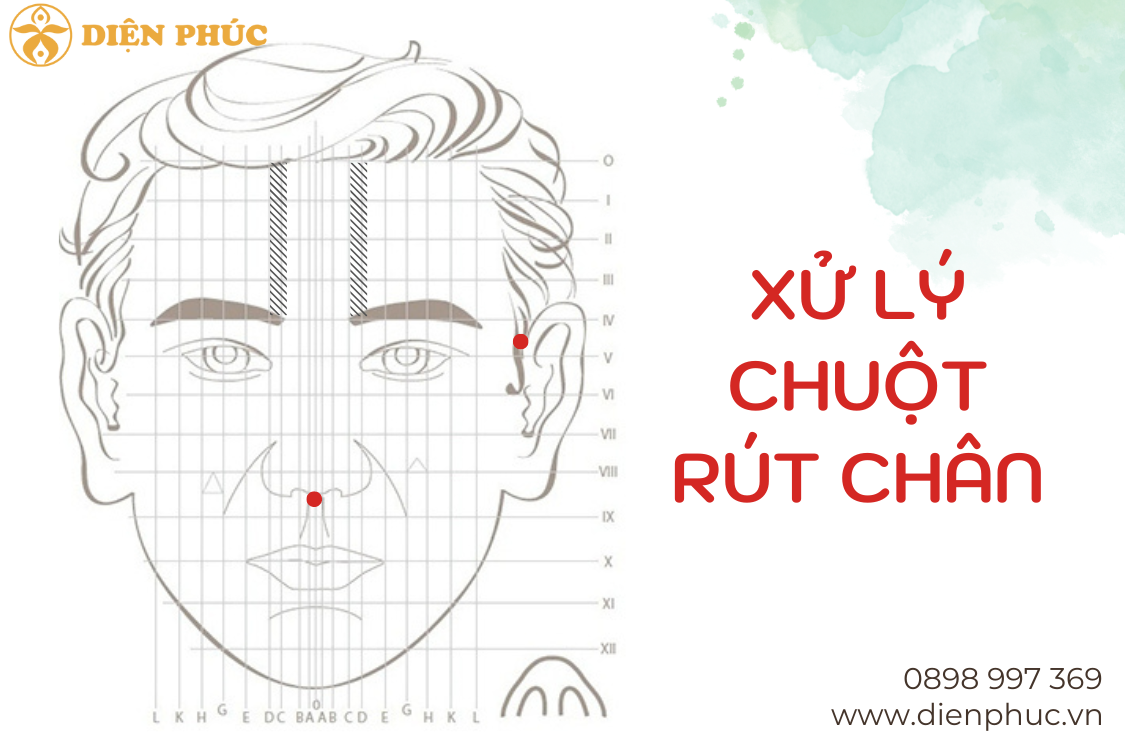 Xử lý chuột rút chân bằng Diện Chẩn ĐKLP