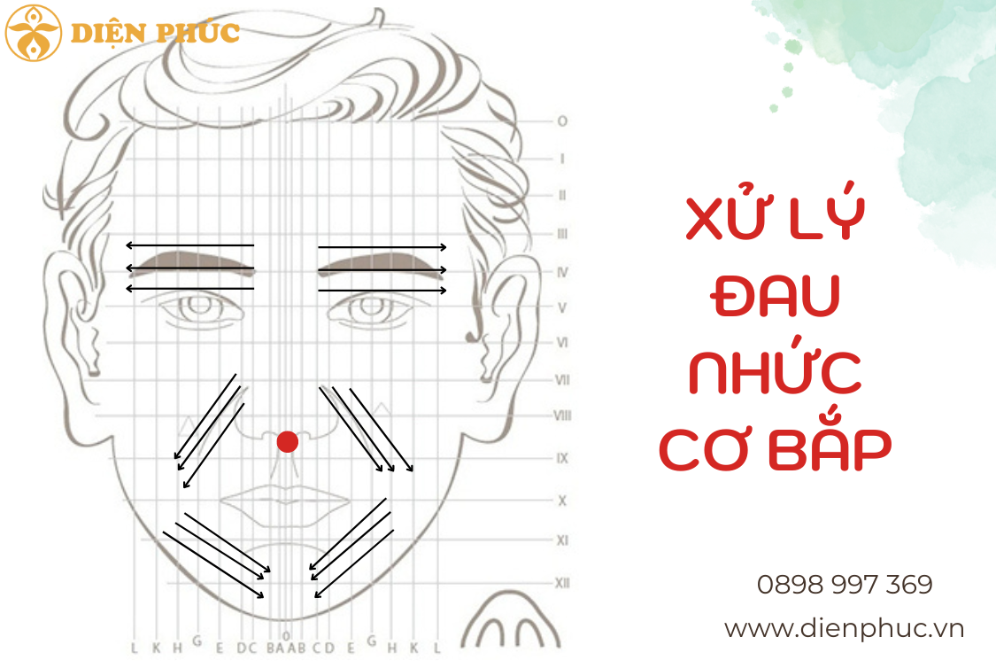 Diện Chẩn xử lý đau nhức cơ bắp